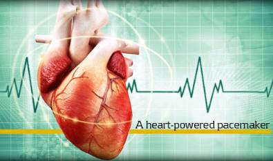 Pacemaker put stroom uit hartslag