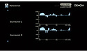 Denon AVC-X8500H Black