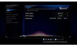 Xtreamer Prodigy