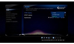 Xtreamer Prodigy