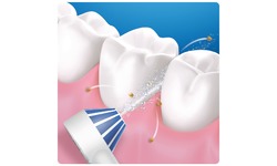 Oral-B AquaCare 4 White